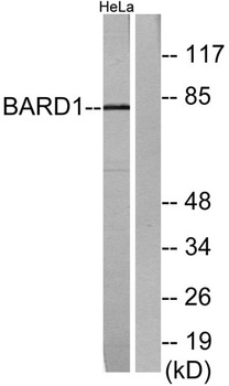 BARD1 rabbit pAb