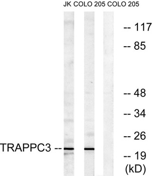 BET3 antibody