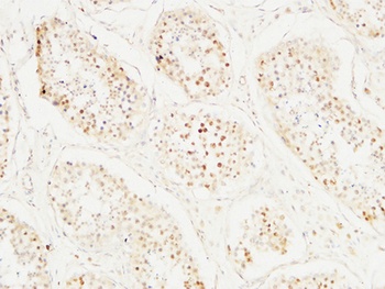 BM28 antibody