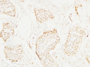 BM28 antibody