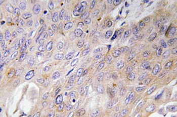 BMP-3 antibody