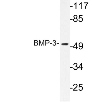 BMP-3 antibody
