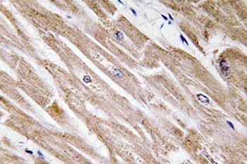 BMP-5 antibody