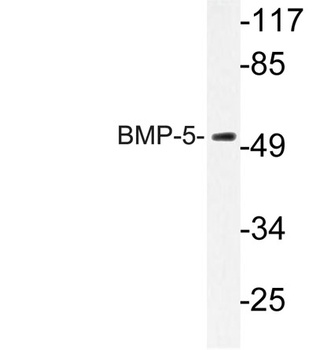 BMP-5 antibody