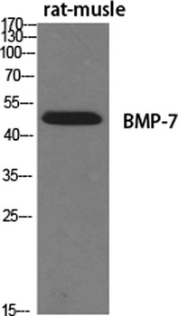 BMP-7 antibody