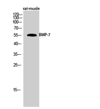 BMP-7 antibody