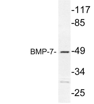 BMP-7 antibody