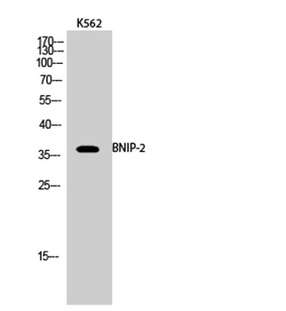 BNIP-2 rabbit pAb