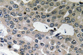 BNIP-2 rabbit pAb