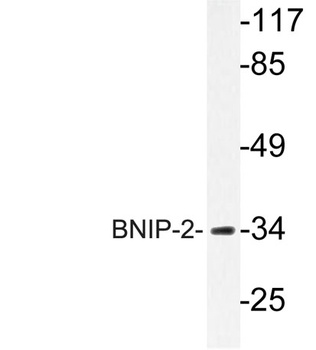 BNIP-2 rabbit pAb