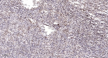 BRAF35 rabbit pAb