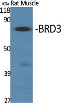 BRD3 rabbit pAb Antibody
