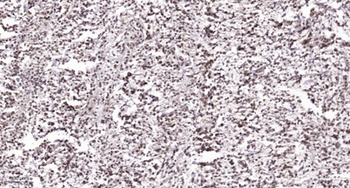 BRD3 antibody