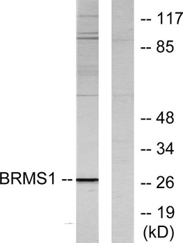 BRMS-1 rabbit pAb