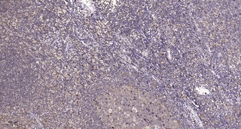 BRMS-1 antibody