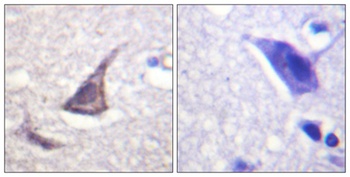 C/EBP ε rabbit pAb