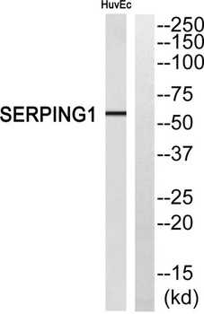 C1INH antibody