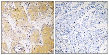 C1INH antibody