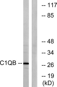 C1q-B rabbit pAb