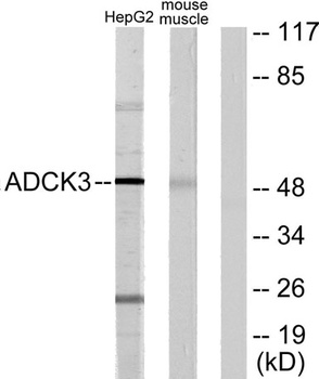 CABC1 rabbit pAb