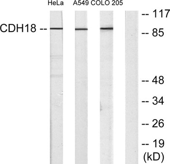 Cadherin-18 rabbit pAb