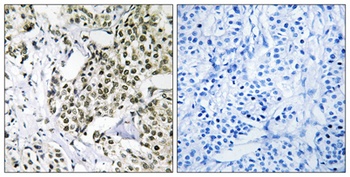 CAGE-1 antibody