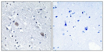 Calponin 2 rabbit pAb