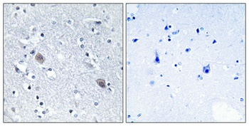 Calponin 2 antibody