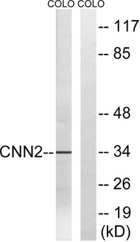 Calponin 2 antibody