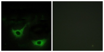 Calregulin antibody