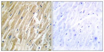 Calregulin rabbit pAb