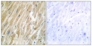 Calregulin antibody