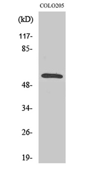 CaMKIIβ/γ rabbit pAb Antibody