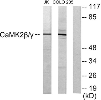 CaMKIIβ/γ rabbit pAb Antibody