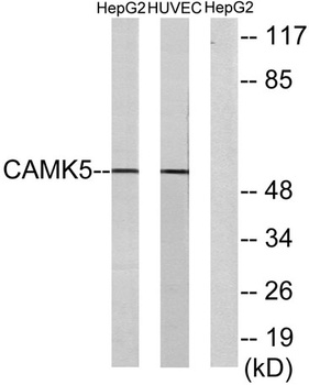 CaMKV antibody