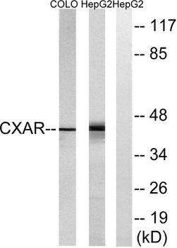 CAR antibody