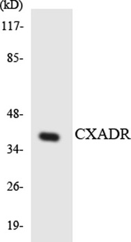 CAR antibody