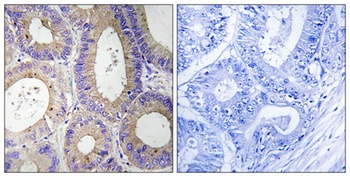 Carbonyl Reductase 3 antibody