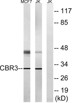 Carbonyl Reductase 3 rabbit pAb