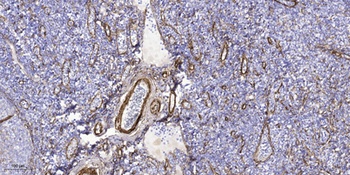 CARD 10 antibody