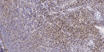 CARD 11 antibody