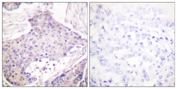 CARD 6 antibody