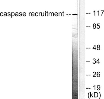 CARD 6 antibody