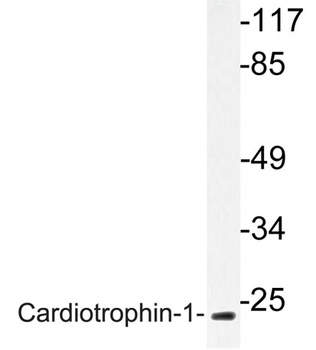 Cardiotrophin-1 antibody