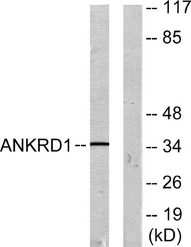 CARP antibody