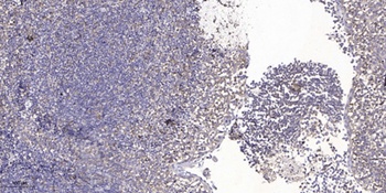 CARP antibody