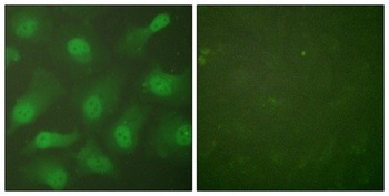 CAS antibody