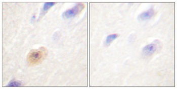 CAS antibody