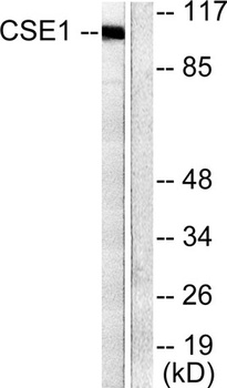 CAS antibody