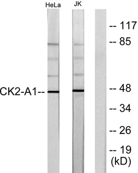 Casein Kinase IIalpha antibody